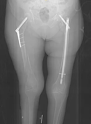 Анатомия нижней конечности | e-Anatomy