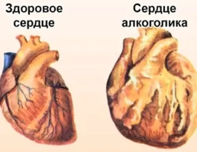 Боль в грудной клетке - сердце или что-то другое, причины боли | Диамед