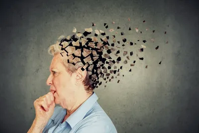 Что такое болезнь Альцгеймера: симптомы, лечение, профилактика -  Медицинский Центр на Ботанической