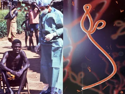 Позорная болезнь: почему выжившие после Эболы стали изгоями | Фотогалереи |  Известия
