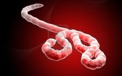 Лихорадка Эбола - симптомы, лечение, профилактика, причины, первые признаки  - болезни и состояния на Здоровье Mail.ru
