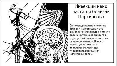 Андрей Константинов - Болезнь Паркинсона — довольно распространенное  дегенеративное заболевание нервной системы. Причины развития болезни  Паркинсона ⤵️ Ученые еще до конца не выяснили, что является основной  причиной заболевания, этот вопрос активно ...