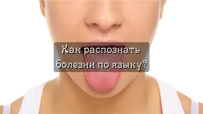 Какие болезни можно узнать по цвету языка | Начни с тренировки | Дзен