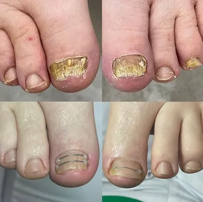 Диагноз на пальцах. Какие болезни можно узнать по состоянию ногтей |  Здоровая жизнь | Здоровье | Аргументы и Факты