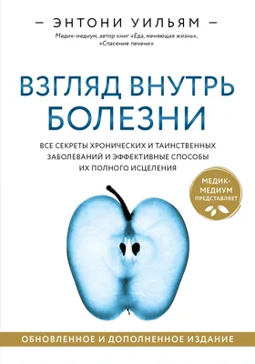 Кессонная болезнь – симптомы, причины, диагностика и лечение заболевания у  взрослых | «Будь Здоров».