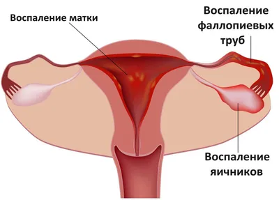 Болит в животе – основные причины синдрома и первая помощь — клиника  «Добробут»