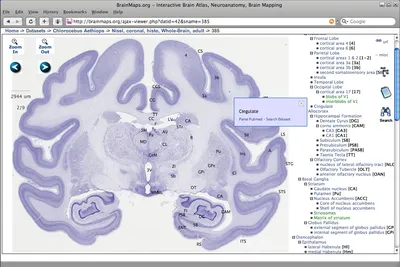 Largest brain map may help scientists study language, diseases : Short Wave  : NPR