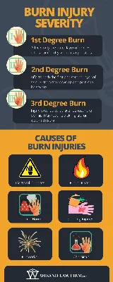 Third degree burn hi-res stock photography and images - Alamy