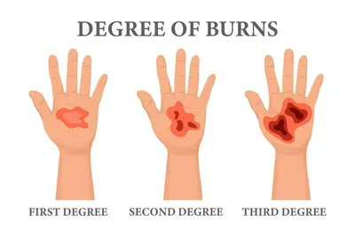 Burn Barrels - North Coast Unified Air Quality Management District