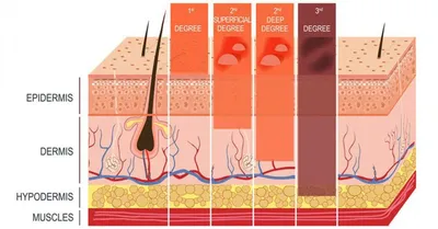 Burn Barrels: Types, Uses, Features and Benefits