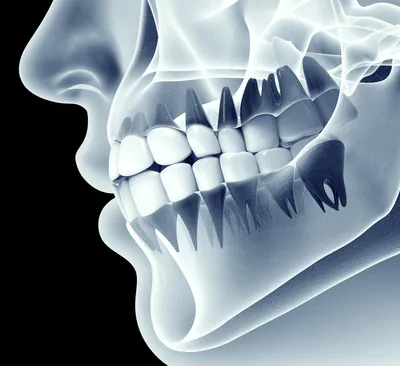 Анатомия челюсти человека — Стоматология «Доктор НеболитЪ»