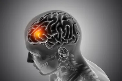 Черепно-мозговая травма – причины, симптомы, диагностика, профилактика и  лечение | Врачи Онлайн