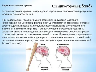 Легкие черепно-мозговые травмы: симптомы, диагностика, лечение в Херсоне |  Neuro.ks.ua.