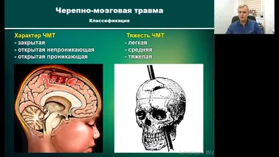 Иллюстрация 4 из 32 для Черепно-мозговая травма. Диагностика и лечение -  Леонид Лихтерман | Лабиринт - книги.