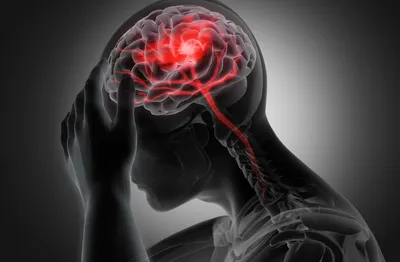 Черепно-мозговая травма: чем она опасна и что нужно делать в первую  очередь? | МЦР | Дзен