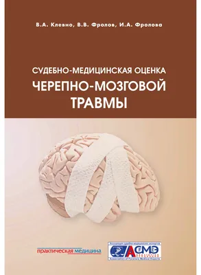 МРТ головного мозга при травмах головы | Клиника Эксперт