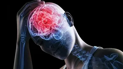 Черепно-мозговая травма • Федеральный Центр Мозга и Нейротехнологий