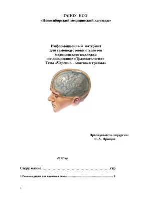 Восстановление после черепно-мозговой травмы - Медицинский центр \"Мирт\" в  Костроме