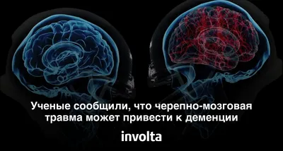 Лекция Черопно-мозговые травмы , неврология и нейрохирургия | Презентации  Неврология | Docsity