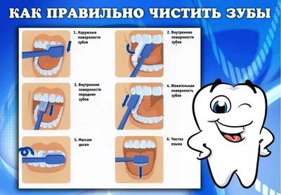 Что будет, если не чистить зубы - Стомус