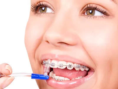 Как правильно чистить зубы ребенку: пошаговая инструкция от педиатров для  детей разного возраста с видео