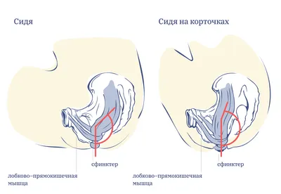 Стало известно, почему ходить в туалет с телефоном может быть опасно