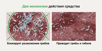 Сражает даже девственников. Что надо знать о молочнице у мужчин - Мужчине  на заметку - 39-я городская клиническая поликлиника