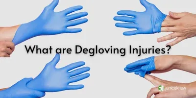 Degloving crush injury to arm from roll-over – Artery Studios –  Medical-Legal Visuals