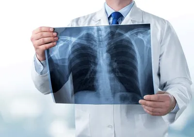 8 листопада - День рентгенолога в Україні та Міжнародний день радіології ::  ЕЛЕКТРОННА ОХОРОНА ЗДОРОВ`Я
