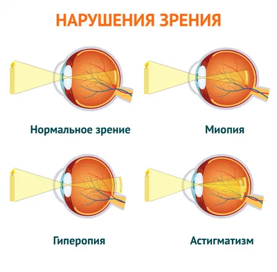 Как повысить остроту зрения? «Ochkov.net»
