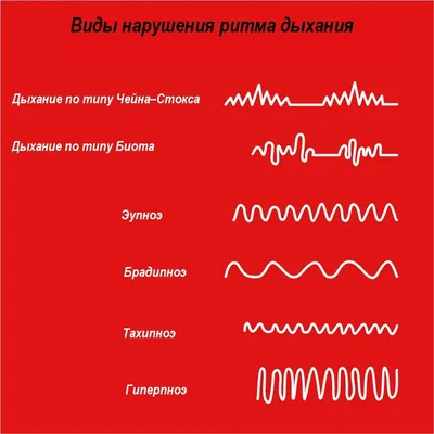 Нет дыхания-нет жизни. Дыхание - это жизнь.