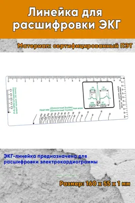 Расшифровка ЭКГ с нагрузкой | Консультация кардиолога в Минске на  DOKTORA.BY - ВРАЧИ БЕЛАРУСИ