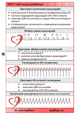 ЭКГ: что это такое, кому назначают и как расшифровать