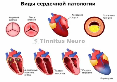 ЭКГ (кардиограмма) - сделать платно в Новосибирске, цены на  электрокардиографию в клинике Инфо-медика