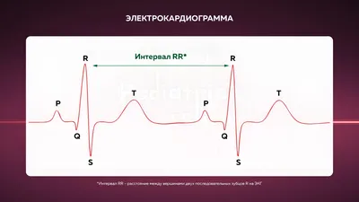 ЭКГ в Красноярске - Диагностика, цены и расшифровка - Сеть медицинских  центров TERVE