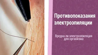 Цены на электроэпиляцию волос в Санкт-Петербурге | Пудра - салоны красоты