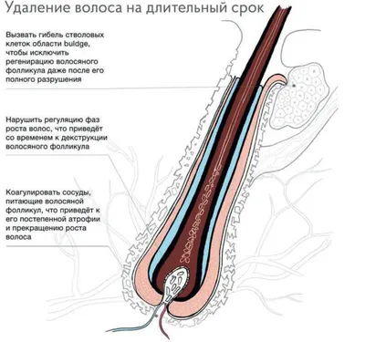 Электроэпиляция - Вся Находка - справочник предприятий города Находка