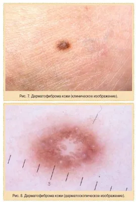 Профилактика кожных заболеваний / Единые дни здоровья - Поликлиника №34