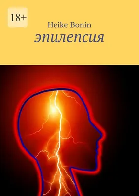 Что нужно знать о приступах эпилепсии