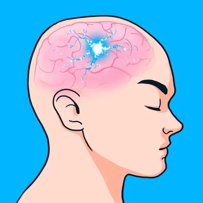Эпилепсия • Федеральный Центр Мозга и Нейротехнологий