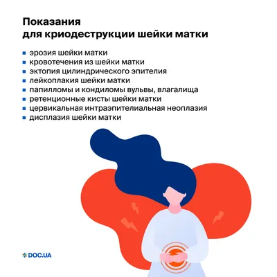 Радиоволновое лечение эрозии шейки матки | Удаление эрозии матки в  Санкт-Петербурге