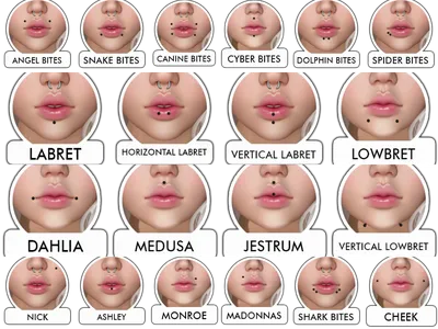 Отзыв о Увеличение губ препаратом Juviderm Ultra 3 | Знаменитая форма губ  Эмильяна Брауде техника ТП. Красиво или уродство?