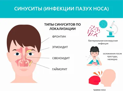 Голова болит, нос не дышит и температура: что такое гайморит и чем он  опасен? | О здоровье: с медицинского на русский | Дзен