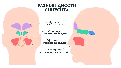 Эндоскопическая гайморотомия (удаление кисты) | КийМедикал медицинский центр