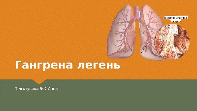 Диабетическая нога. Гангрена. Язвы применяют кожу с болячкам пешком  Иллюстрация штока - иллюстрации насчитывающей людск, иллюстрация: 173258618