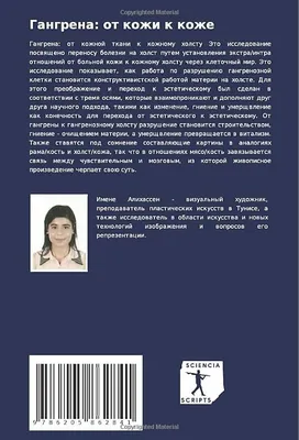 Газовая гангрена - это очень тяжелый инфекционный процесс, который  развивается в результате инфицирования ран анаэробными бактериями,  характеризуется... | By Центр \"Диабетическая стопа\" | Facebook