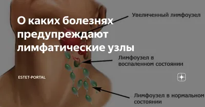 Почему воспаляются лимфоузлы? | Блог о здоровье