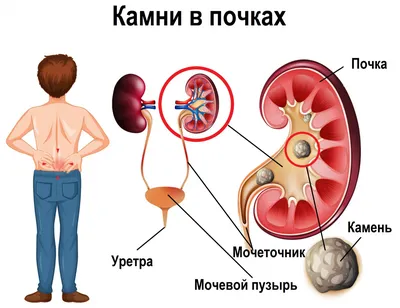 Почему воспаляются лимфоузлы у детей и взрослых? - YouTube