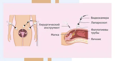 Матка человека — Википедия