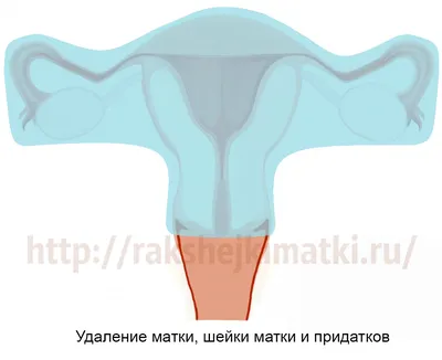 Клиника Виталис - Здравствуйте! 👉Это очень распространённый миф.  Большинство пугали тем, что сидя на холодном можно «застудить» почки или  придатки, получить недержание мочи или бесплодие. На самом деле эти органы  находятся глубоко